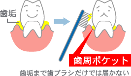 治療方法