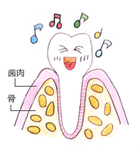 歯周病の原因
